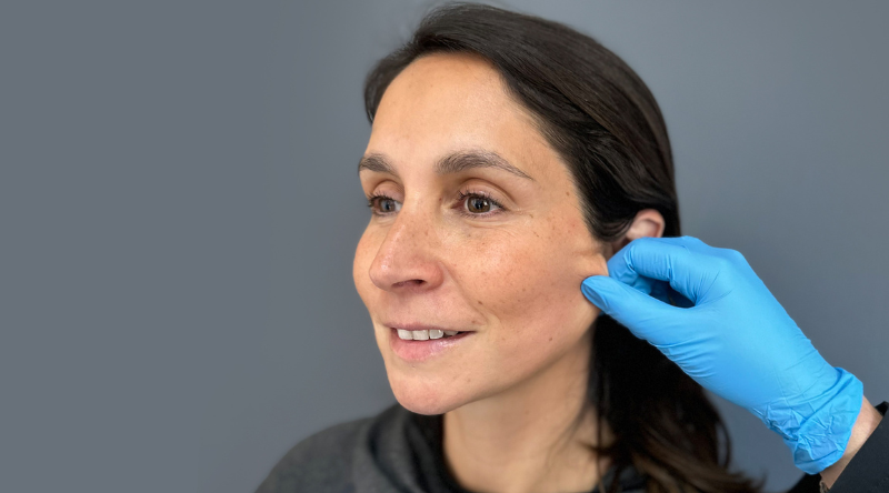 Bioestimulación con Radiesse: firmeza y elasticidad real