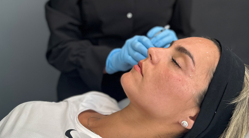 Botox Preventivo: Retarda Arrugas con Opinión Médica