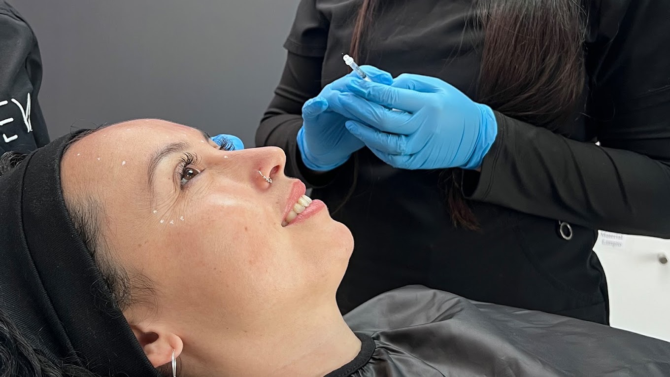 Botox en Oferta: Rejuvenece en la Toxina Week