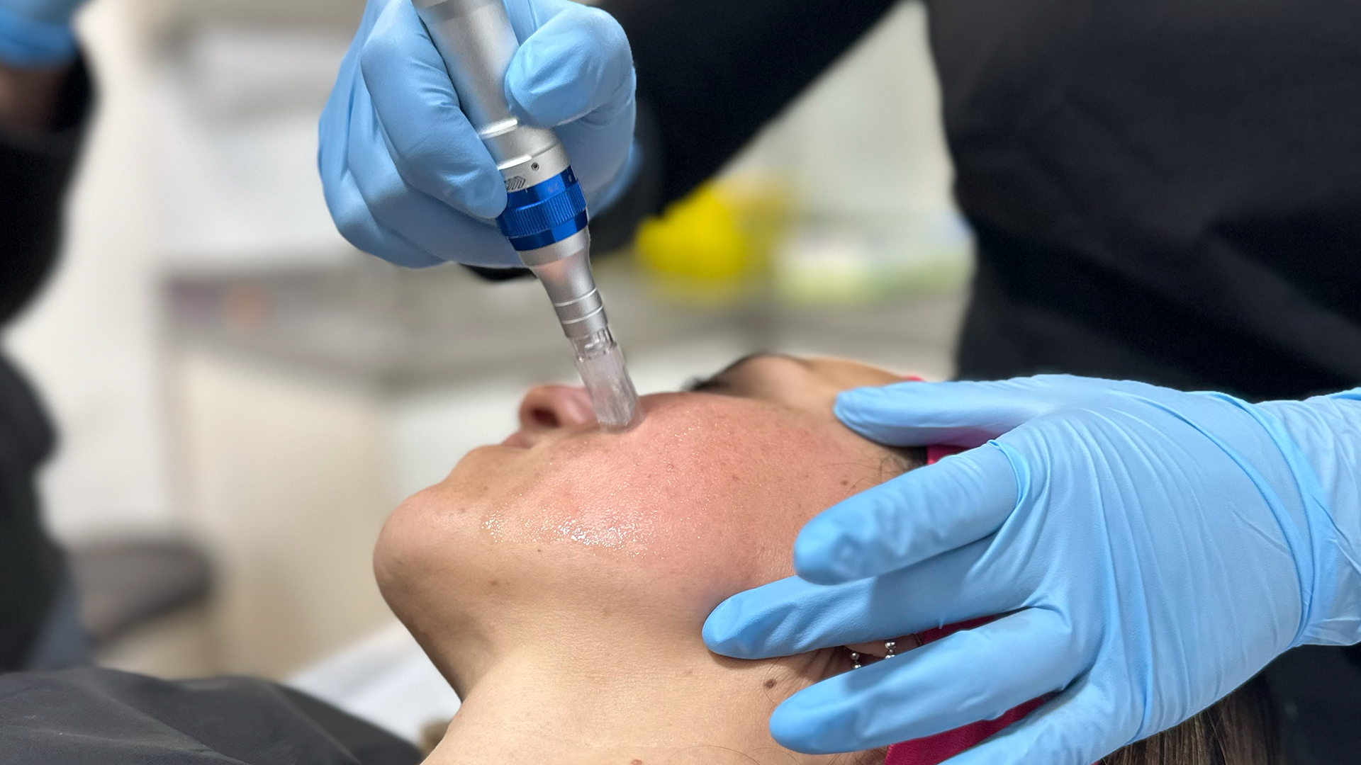 Cyber Estética 2025: Ofertas Exclusivas en Medicina Estética
