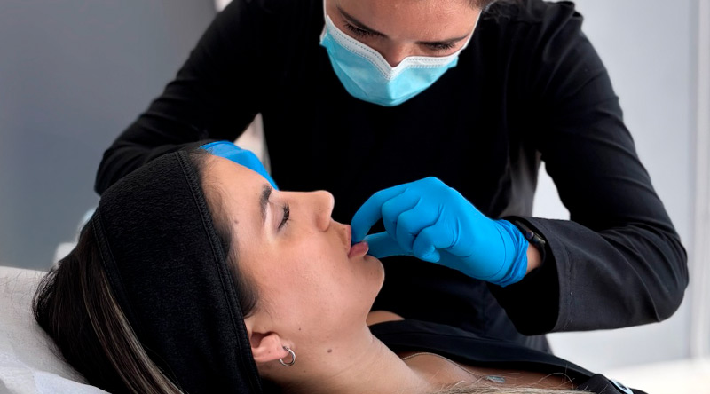 Descubre las diferencias clave del ácido hialurónico en labios y líneas de código de barras. Conoce los tratamientos ideales en medicina estética para rejuvenecer tu rostro.