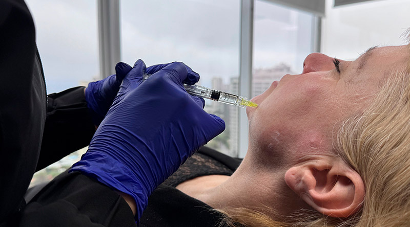 NucleoFill Strong regeneración facial natural
