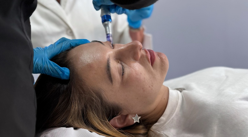 Plasma rico en plaquetas tratamiento facial regenerativo en Clínica EM