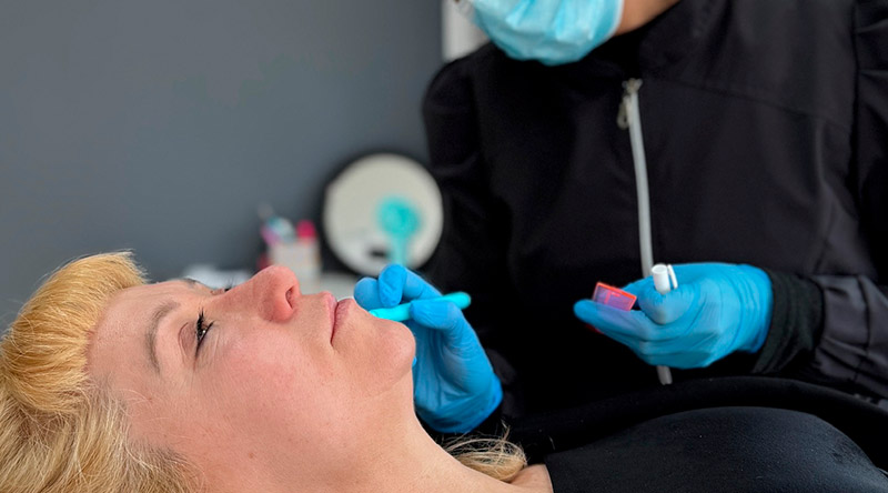 aplicación profesional de NucleoFill Strong en Clínica EM.