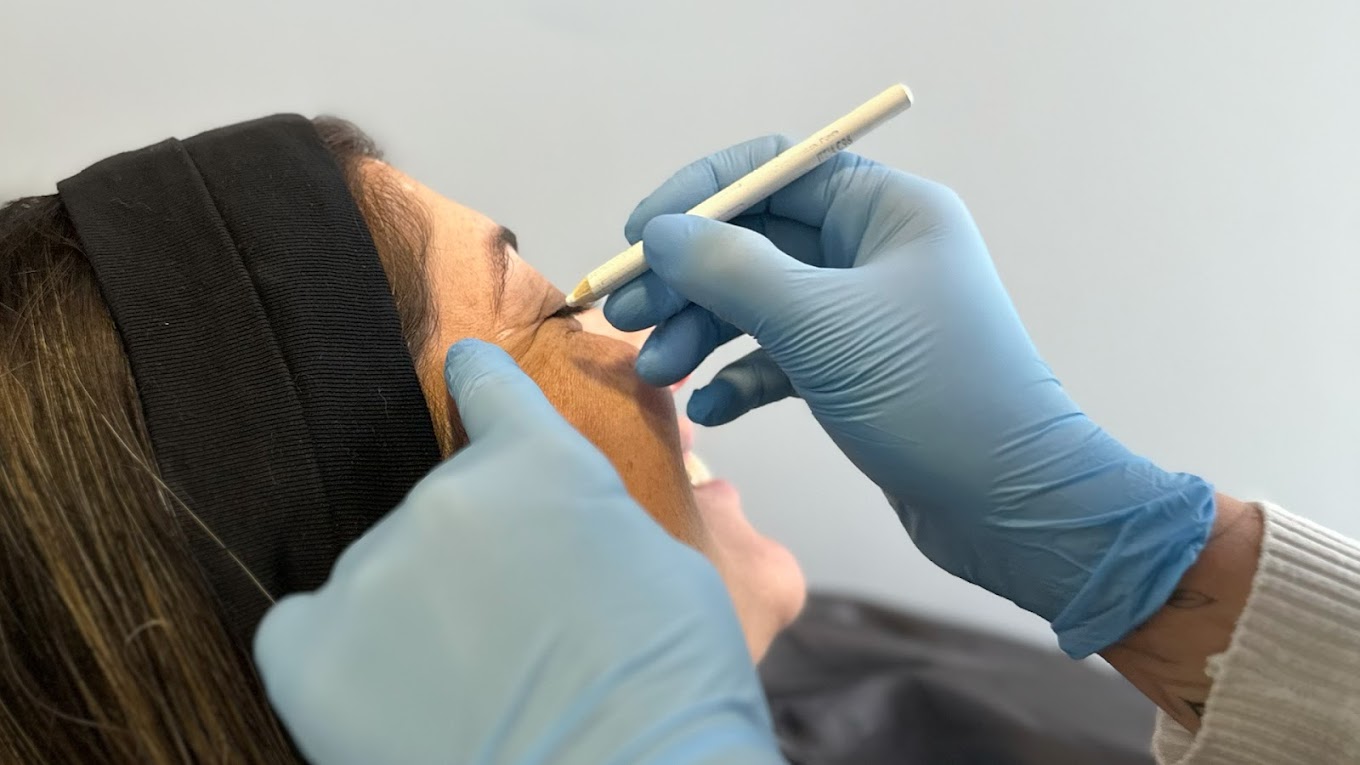 miedos estéticos tratamiento seguro Clínica EM