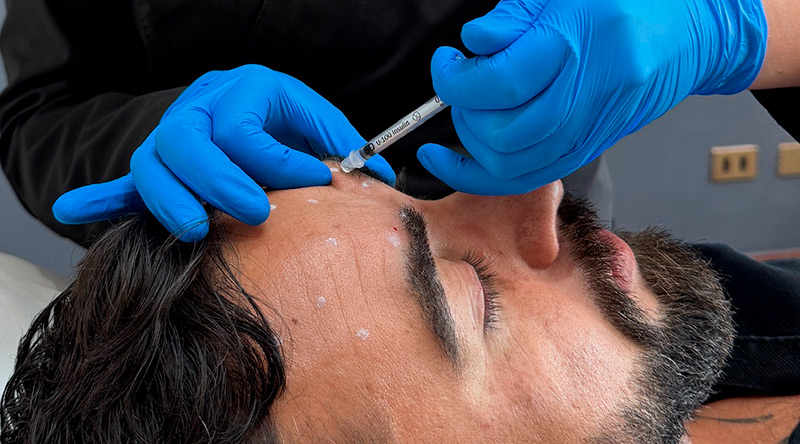 procedimiento de botox seguro y profesional