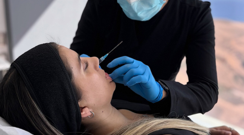 procedimiento relleno labios con acido hialuronico