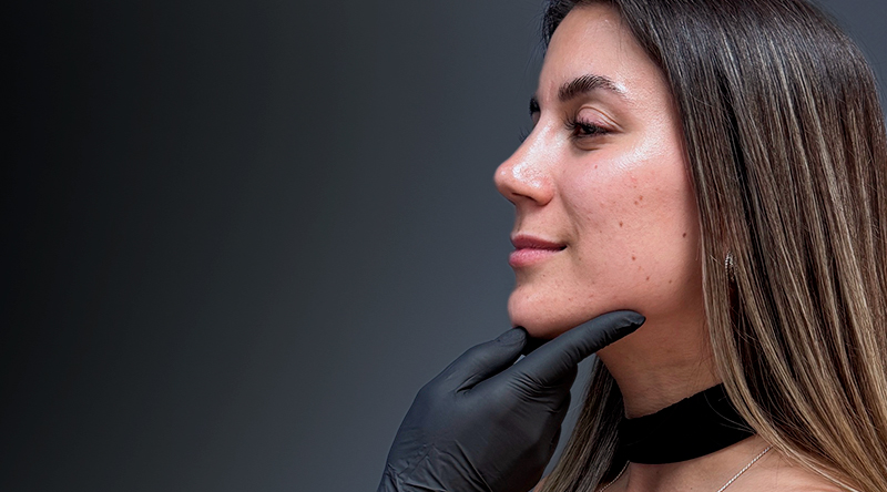 relleno o aumento de labios black friday clinica em