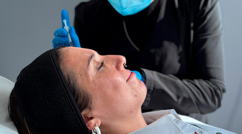 toxina botulinica clinica em aplicacion segura