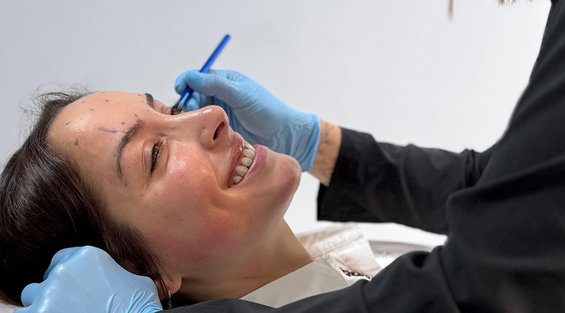 toxina botulinica facial clinica em