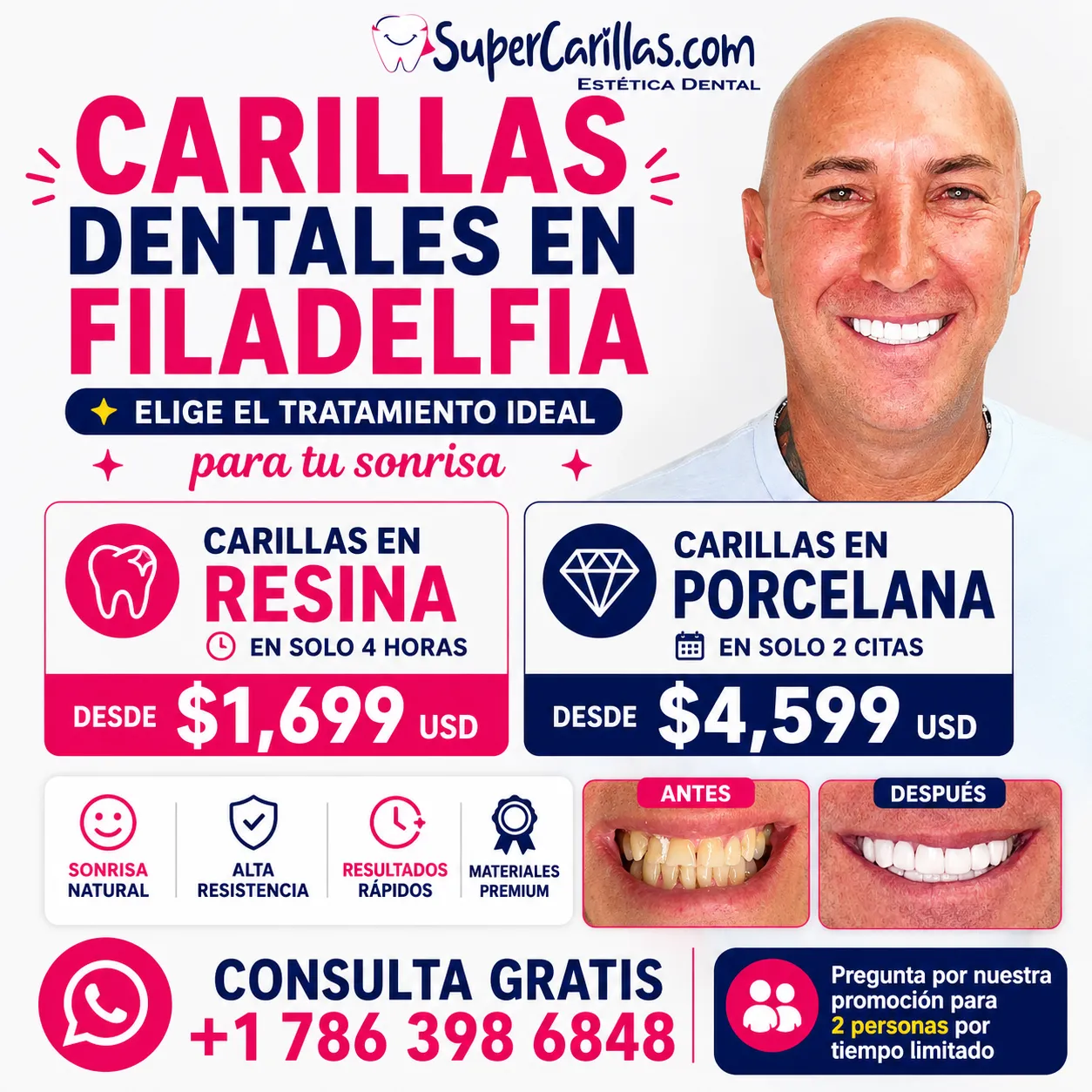 Carillas dentales en Philadelphia