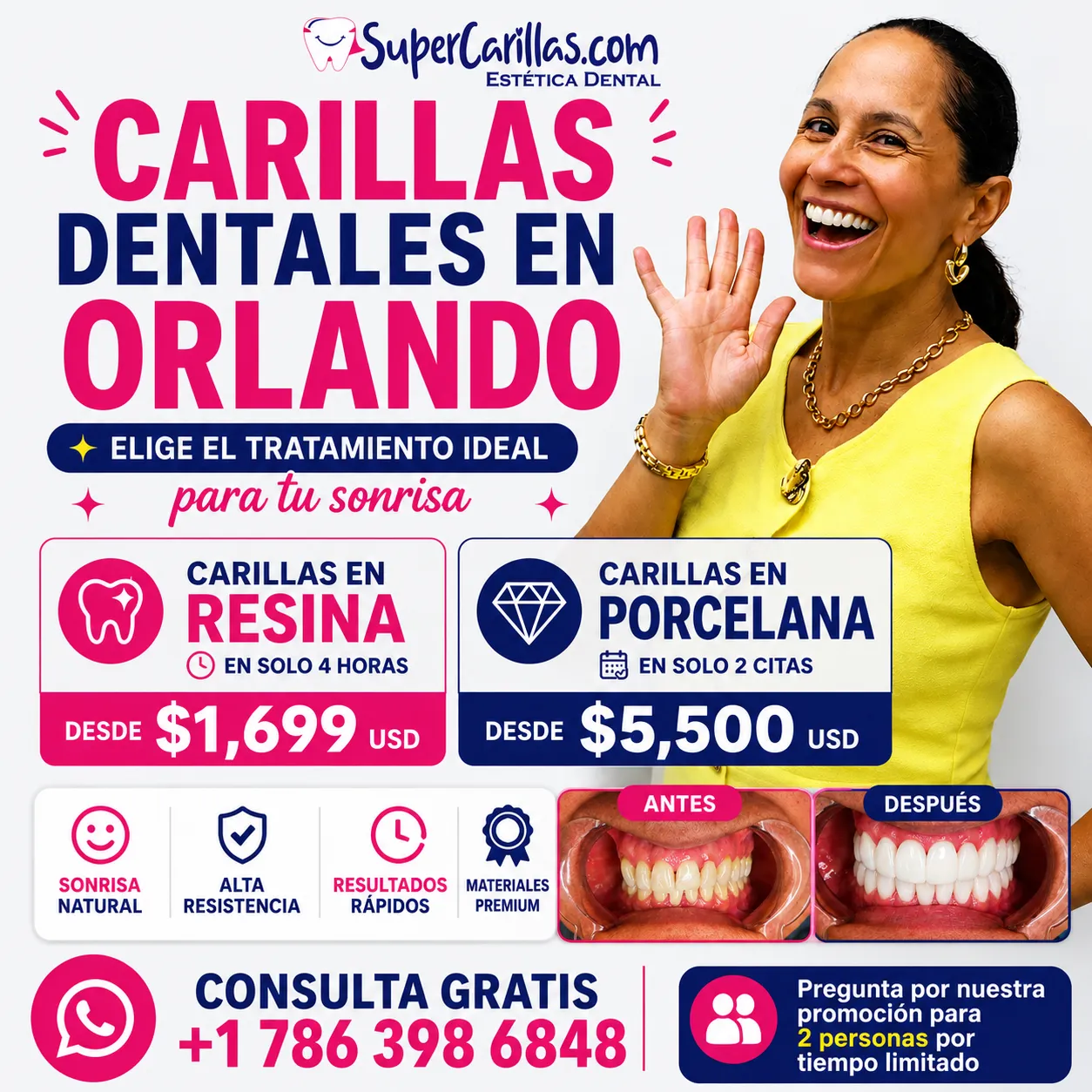 Carillas dentales en Orlando