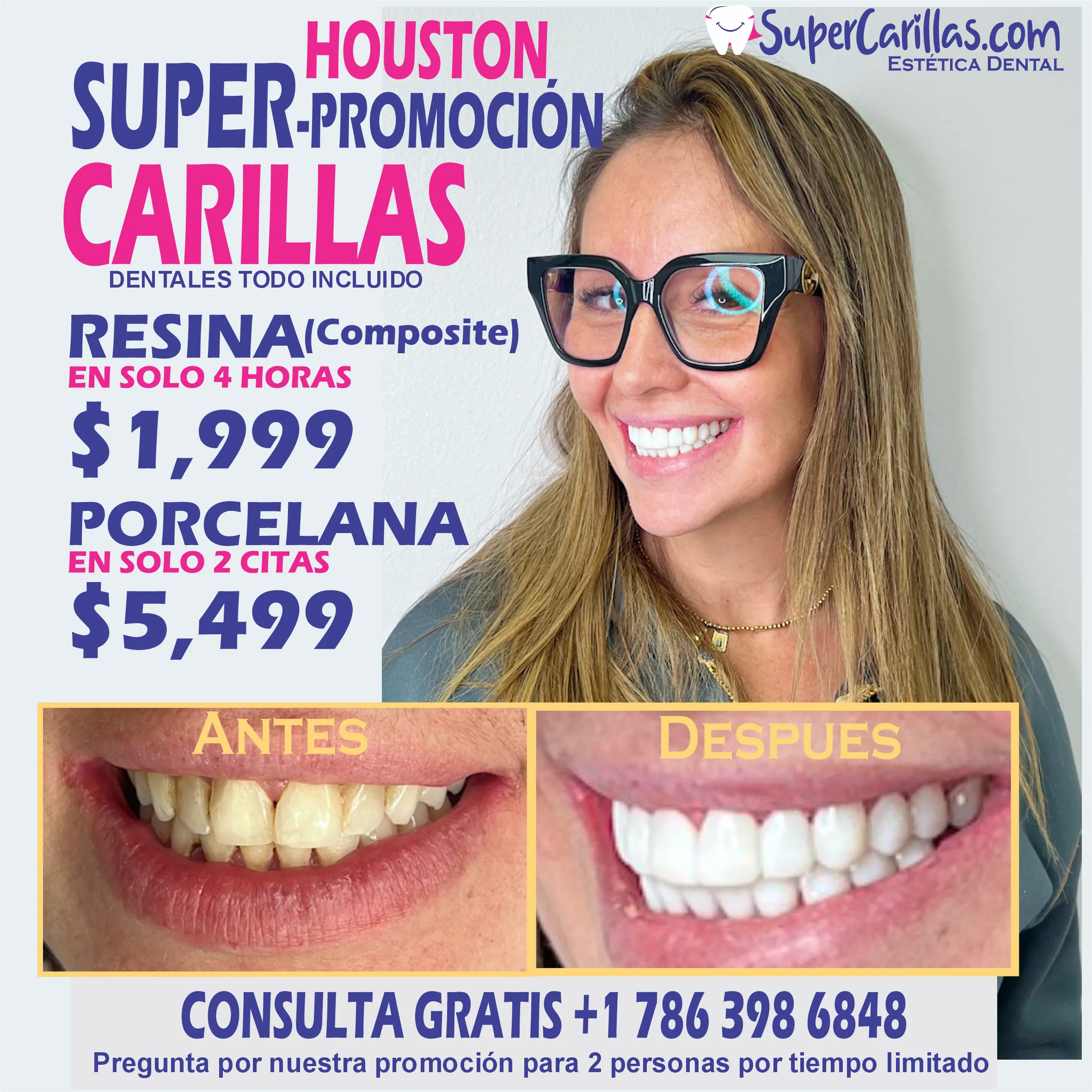 Carillas dentales en houston