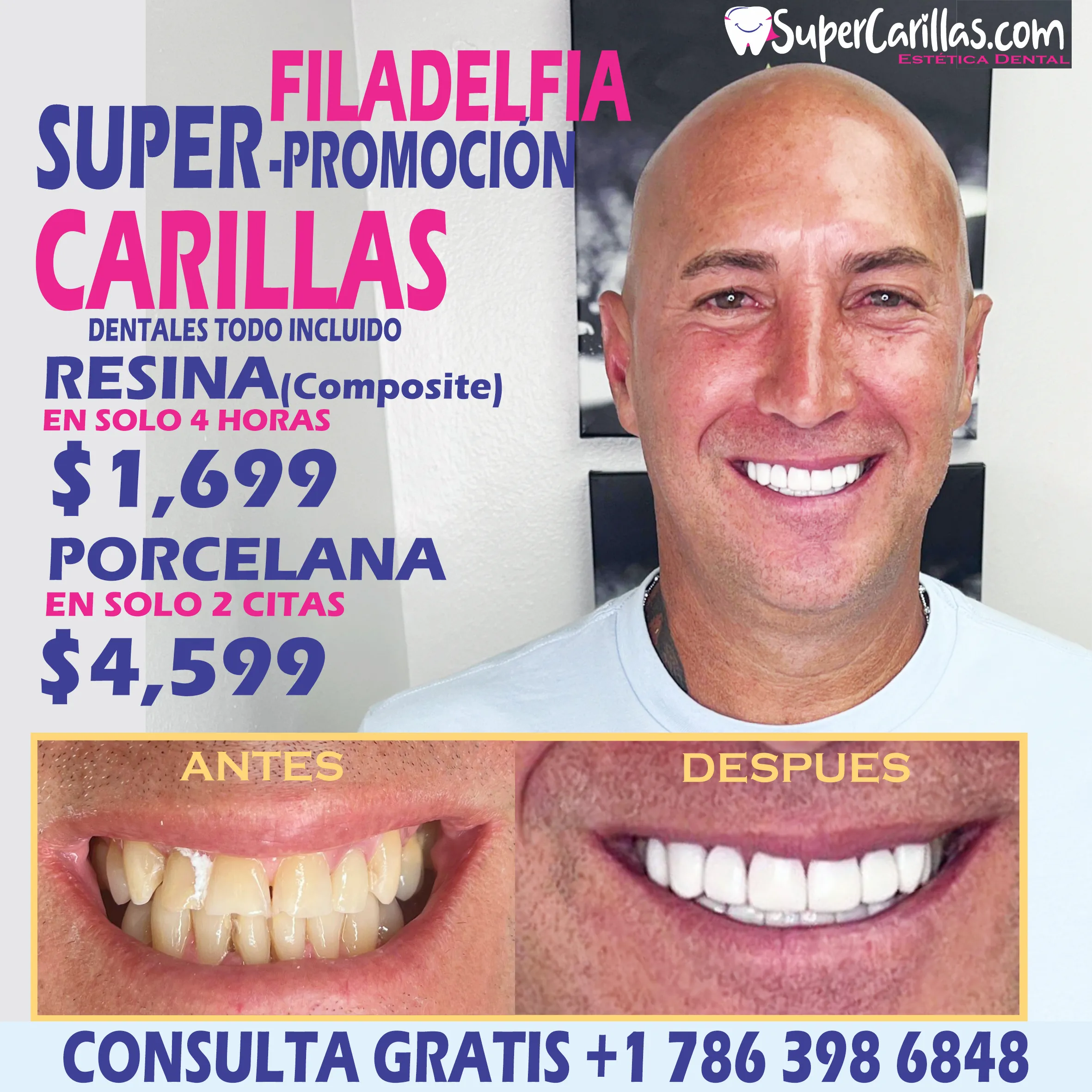 Carillas dentales en Philadelphia