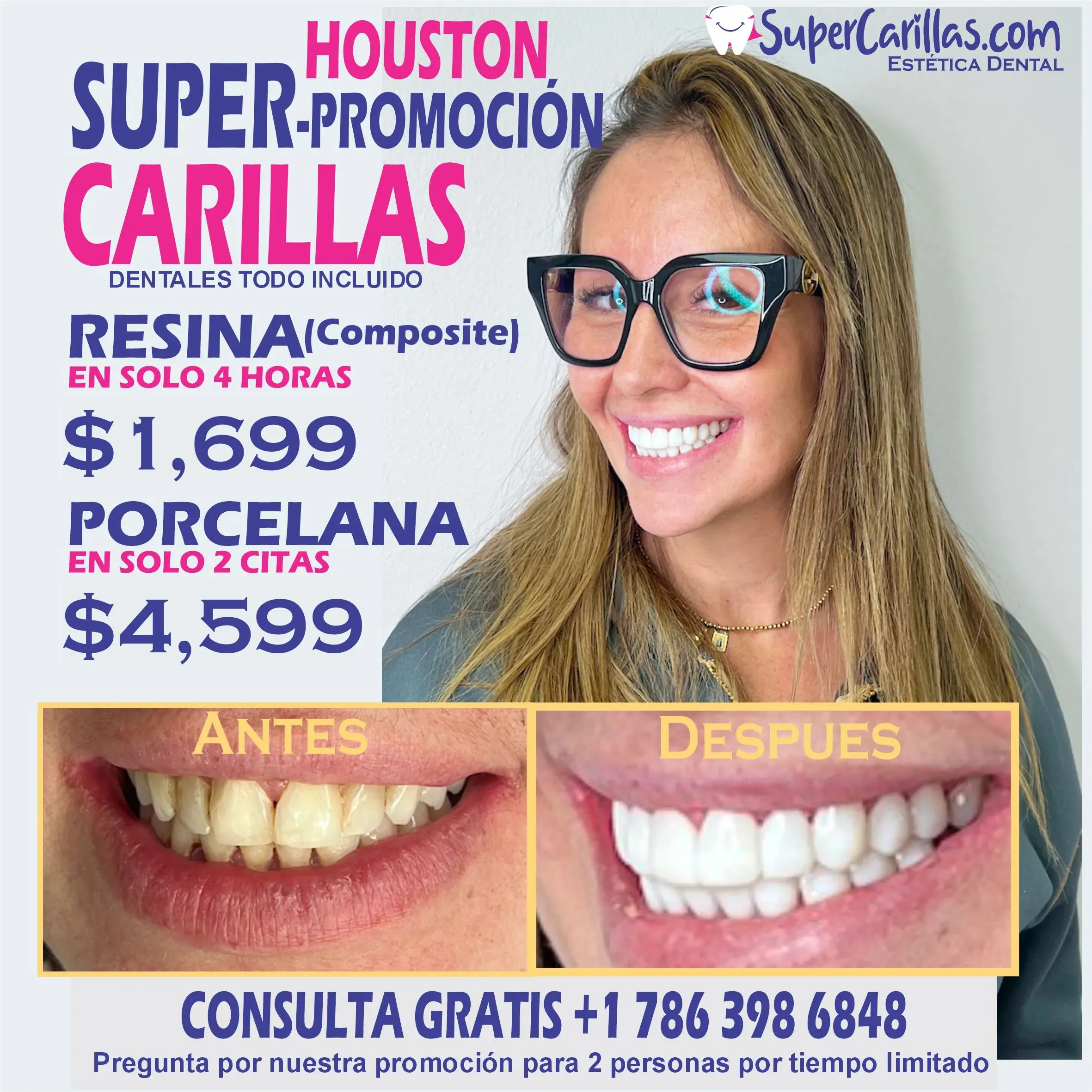 Carillas dentales en houston