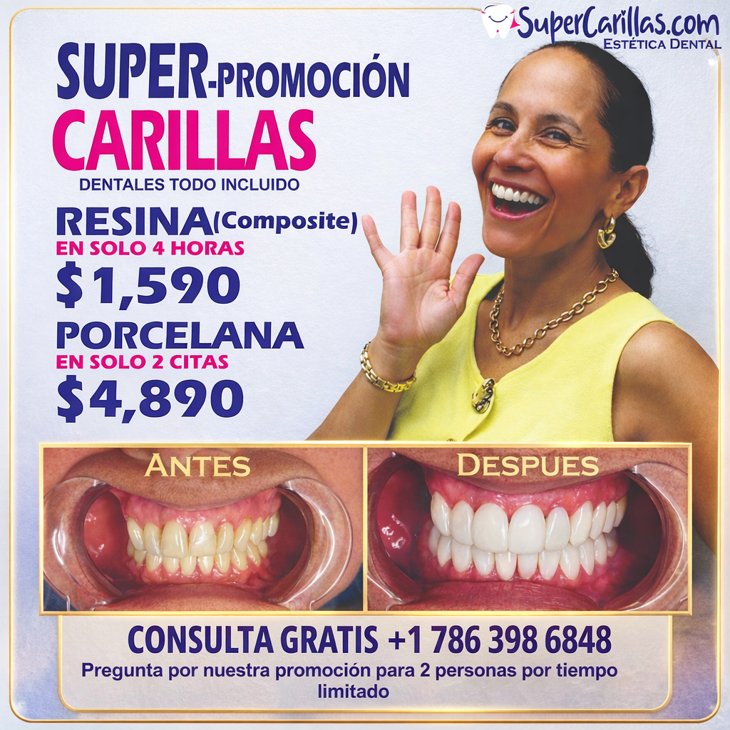 Carillas dentales en Orlando