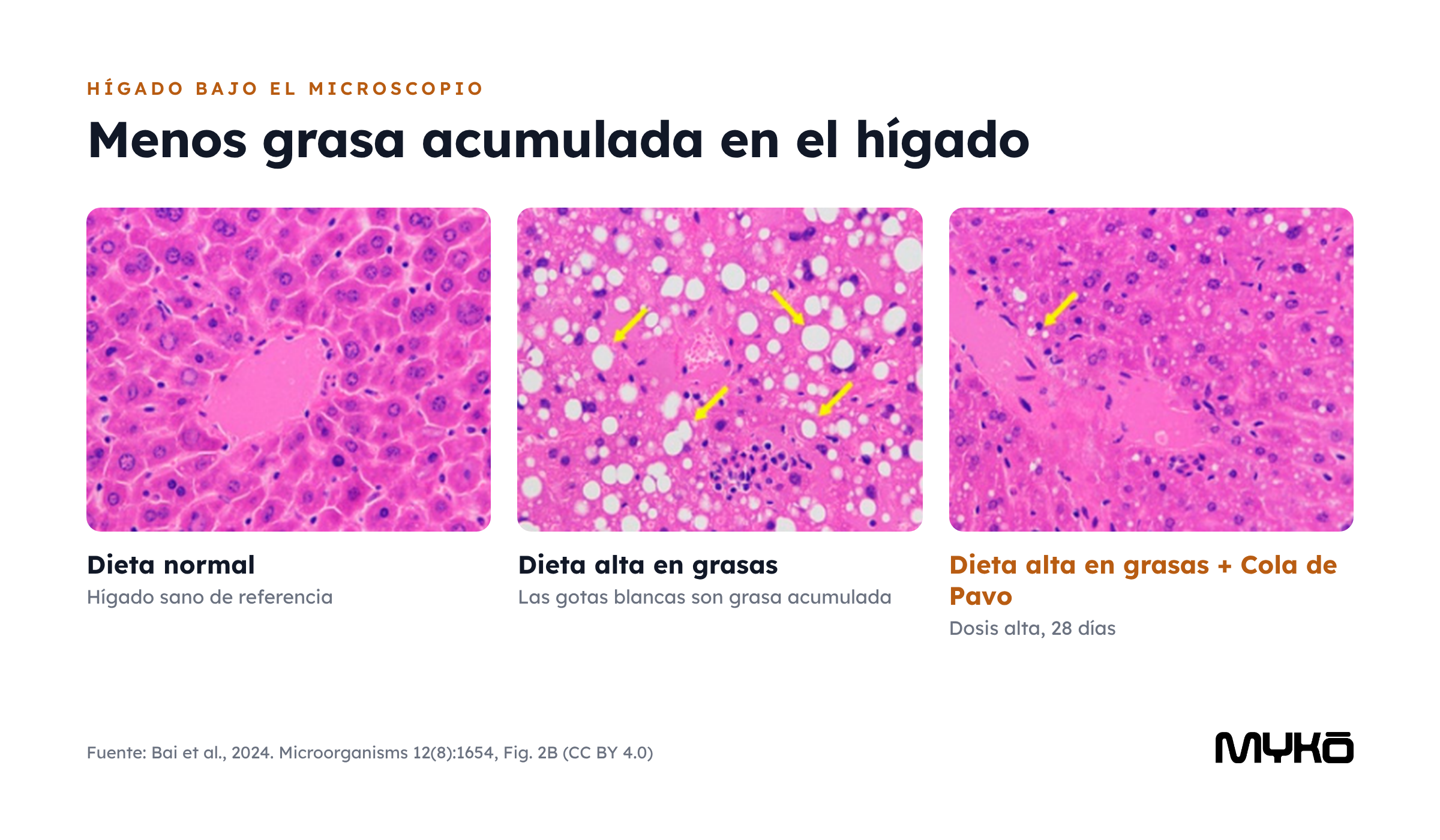 Hígado de ratón al microscopio: dieta normal, dieta alta en grasas y dieta alta en grasas con Cola de Pavo