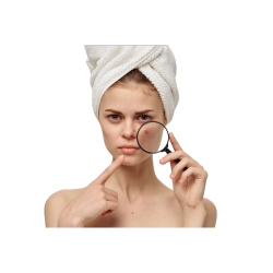 Manchas y Cicatrices