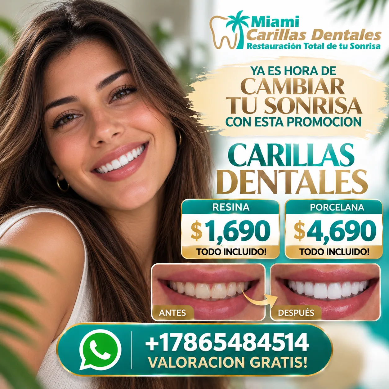 Antes y después con carillas dentales en Miami en paciente mujer (caso real)